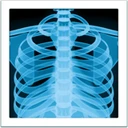 Radiographie